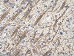 ZNF74 Polyclonal Antibody