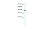 ZNF322A Polyclonal Antibody