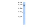 RFX5 Polyclonal Antibody