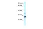 CDX1 Polyclonal Antibody