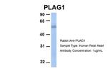 PLAG1 Antibody in Western Blot (WB)