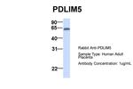 PDLIM5 Antibody in Western Blot (WB)