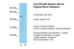 PDLIM5 Polyclonal Antibody