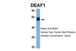 DEAF1 Antibody in Western Blot (WB)