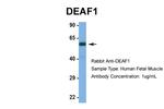 DEAF1 Antibody in Western Blot (WB)
