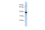 RNF34 Polyclonal Antibody