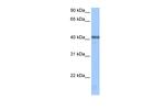 APOBEC3F Polyclonal Antibody