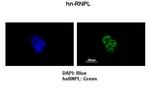 hnRNP L Polyclonal Antibody