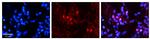 SNRNP70 Polyclonal Antibody