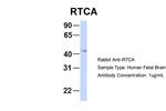 RTCA Polyclonal Antibody