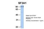 SF3A1 Polyclonal Antibody