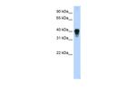 TIA-1 Polyclonal Antibody