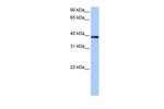 MRM1 Polyclonal Antibody