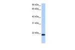 TMED4 Polyclonal Antibody