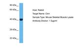 Creatine Kinase MB Polyclonal Antibody