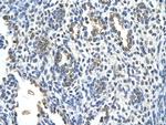 Cytokeratin 2e Polyclonal Antibody