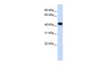 Alcohol Dehydrogenase 1B Antibody in Western Blot (WB)