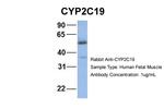 CYP2C19 Polyclonal Antibody