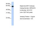 Cytokeratin 1 Antibody in Western Blot (WB)