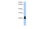 RhoD Antibody in Western Blot (WB)