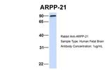 ARPP21 Polyclonal Antibody
