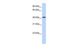LRRC2 Polyclonal Antibody