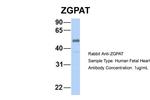ZGPAT Antibody in Western Blot (WB)