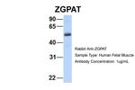 ZGPAT Polyclonal Antibody