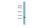 ITGB1BP3 Polyclonal Antibody