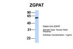 ZGPAT Polyclonal Antibody