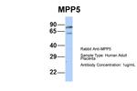 MPP5 Polyclonal Antibody