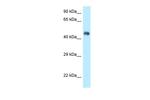 FBXL3 Polyclonal Antibody