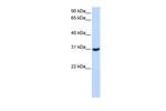 RNF182 Polyclonal Antibody