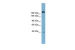 ABCC11 Polyclonal Antibody