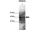 SRD5A2 Polyclonal Antibody