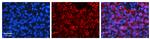 PSEN2 Polyclonal Antibody