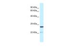 YIPF5 Polyclonal Antibody