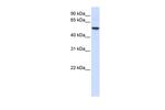 ENTPD8 Antibody in Western Blot (WB)