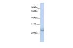 PSMB9 Polyclonal Antibody