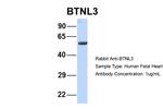 BTNL3 Antibody in Western Blot (WB)