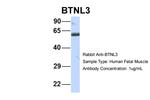 BTNL3 Antibody in Western Blot (WB)