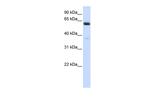 ALG6 Polyclonal Antibody