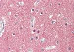 SV2A Antibody in Immunohistochemistry (Paraffin) (IHC (P))