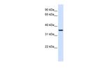 TMX2 Antibody in Western Blot (WB)