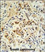 BID Polyclonal Antibody