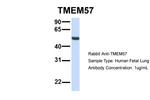 TMEM57 Antibody in Western Blot (WB)