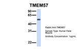 TMEM57 Antibody in Western Blot (WB)