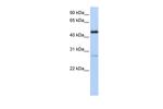NR2F1 Polyclonal Antibody