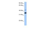 GNB2 Polyclonal Antibody