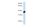 CLN8 Polyclonal Antibody